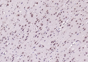 Neuro D4 antibody