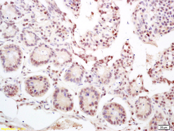 NKAP Rabbit Polyclonal Antibody