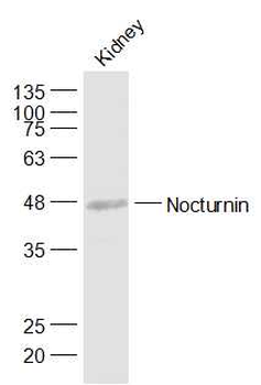 NOCT Rabbit Polyclonal Antibody