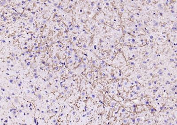 NOTCH1 Rabbit Polyclonal Antibody