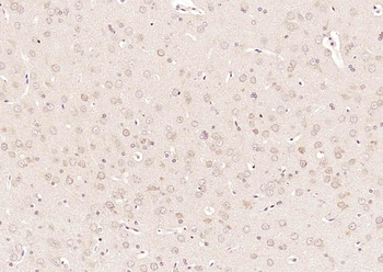 NR0B2 Rabbit Polyclonal Antibody
