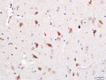 Optineurin Rabbit Polyclonal Antibody