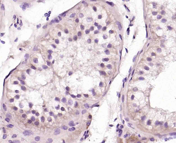 OSR1 + OSR2 Rabbit Polyclonal Antibody