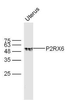 P2RX6 Rabbit Polyclonal Antibody