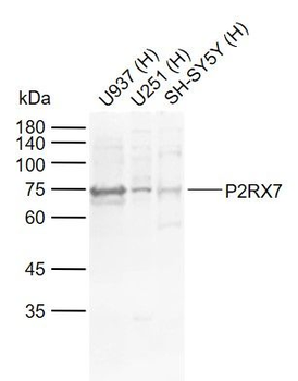P2RX7 Rabbit Polyclonal Antibody