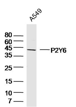 P2Y6 Rabbit Polyclonal Antibody