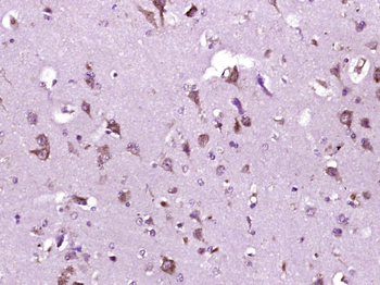 P2Y9 Rabbit Polyclonal Antibody