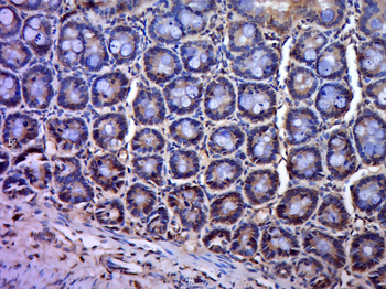 PAG1 Rabbit Polyclonal Antibody