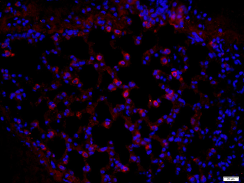 Pan Cytokeratin Rabbit Polyclonal Antibody