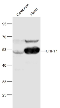 CHPT1 Rabbit Polyclonal Antibody