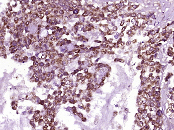 PCDHB10 Rabbit Polyclonal Antibody