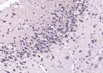 PCP4 Rabbit Polyclonal Antibody