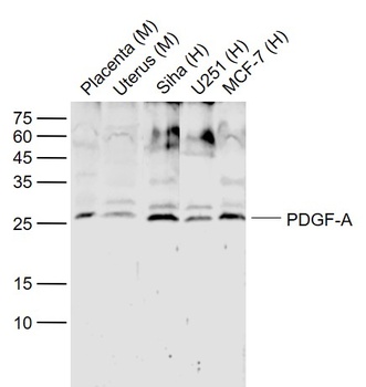 PDGF-A antibody