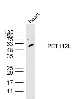 PET112L Rabbit Polyclonal Antibody