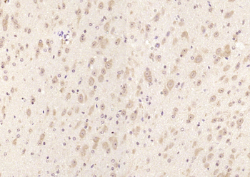 PICALM Rabbit Polyclonal Antibody