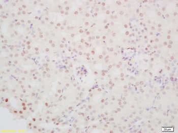 PINX-1 Rabbit Polyclonal Antibody
