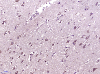 PISD Rabbit Polyclonal Antibody