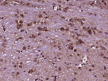 PLXNB3 Rabbit Polyclonal Antibody