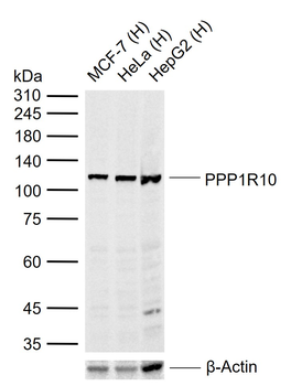 PPP1R10 Rabbit Polyclonal Antibody