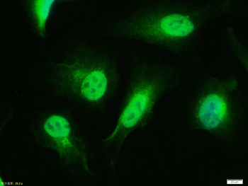 Phospho-PPAR Gamma (ser273) Rabbit Polyclonal Antibody