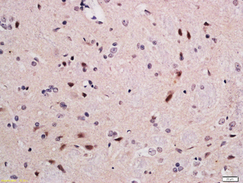 PPP2R5D Rabbit Polyclonal Antibody