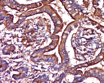 PR3 Rabbit Polyclonal Antibody