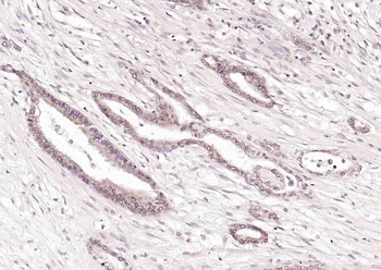 PTBP1 Rabbit Polyclonal Antibody