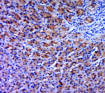 ROCK1 + ROCK2 Rabbit Polyclonal Antibody