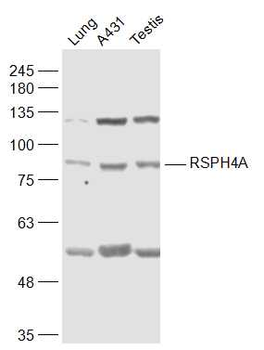 RSPH4A Rabbit Polyclonal Antibody