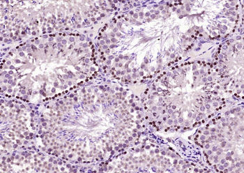 S100A6 Rabbit Polyclonal Antibody