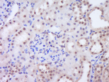 SALL1 Rabbit Polyclonal Antibody