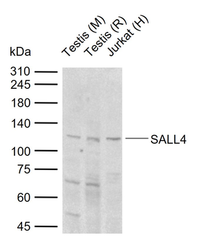 SALL4 Rabbit Polyclonal Antibody