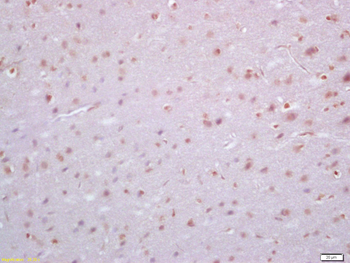 SALL4 Rabbit Polyclonal Antibody