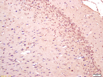 MPP3/SAP102 Rabbit Polyclonal Antibody