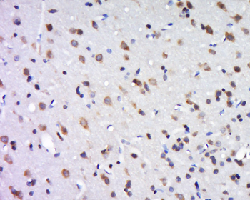 DLGAP2 Rabbit Polyclonal Antibody