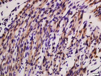 Sarcomeric Alpha Actinin Rabbit Polyclonal Antibody