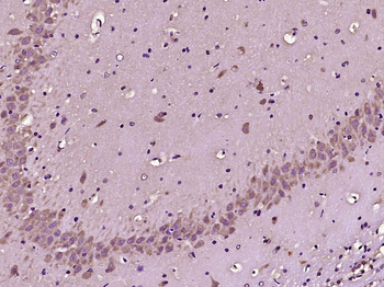 SCN7A Rabbit Polyclonal Antibody