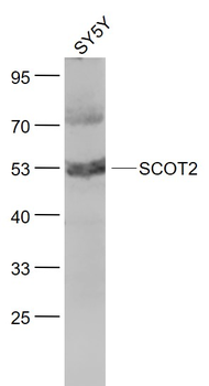 SCOT2 Rabbit Polyclonal Antibody