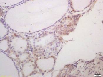 SCXA Rabbit Polyclonal Antibody