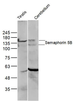 Semaphorin 5B Rabbit Polyclonal Antibody