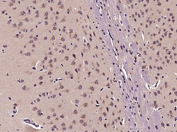 Semaphorin 3D Rabbit Polyclonal Antibody