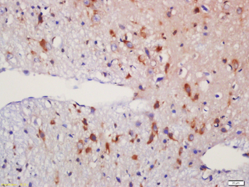 SGSH Rabbit Polyclonal Antibody