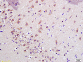 SHANK3 Rabbit Polyclonal Antibody