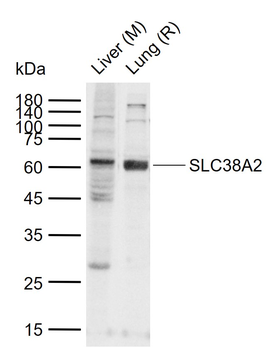 SLC38A2 Rabbit Polyclonal Antibody