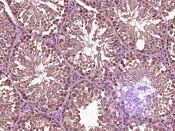 SLFNL1 Rabbit Polyclonal Antibody
