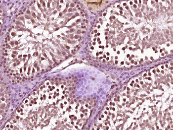 SLFNL1 Rabbit Polyclonal Antibody