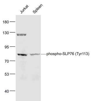 SLP76 (Phospho-Tyr113) antibody