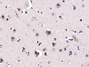 Phospho-Smad1 (Ser463) Rabbit Polyclonal Antibody