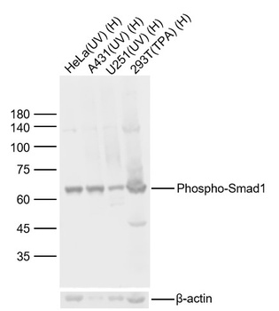 Smad1 (Phospho-Ser465) antibody