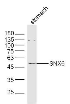 SNX6 Rabbit Polyclonal Antibody